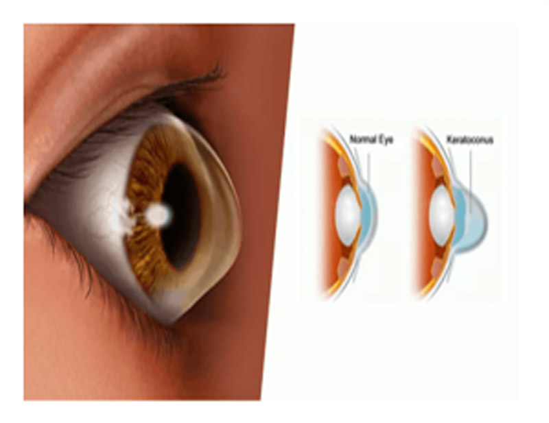DD Eye