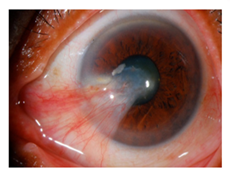 DD Eye