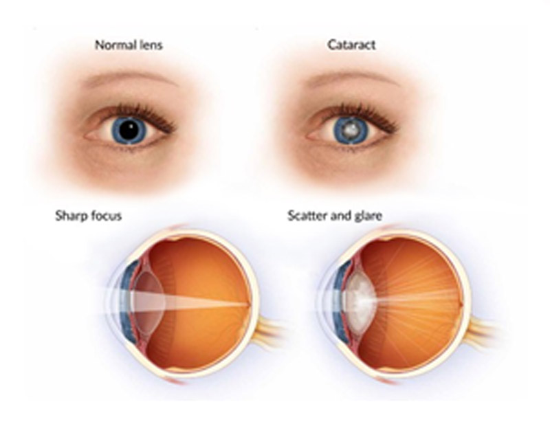 DD Eye