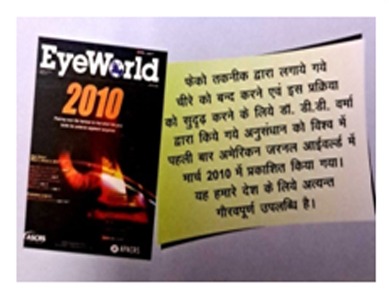 DD Eye