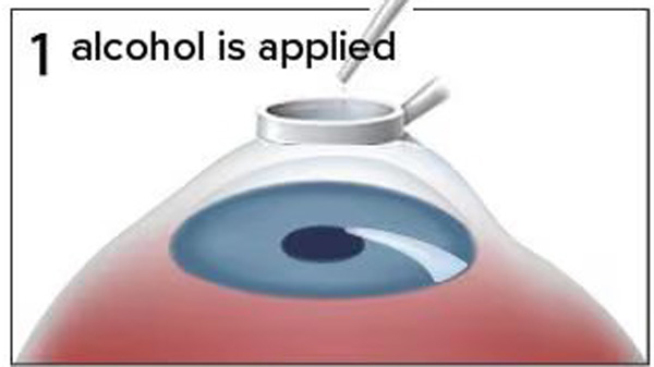 DD Eye  Institute