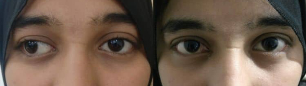 DD Eye  Institute