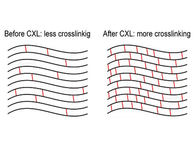 DD Eye Institute - C3R