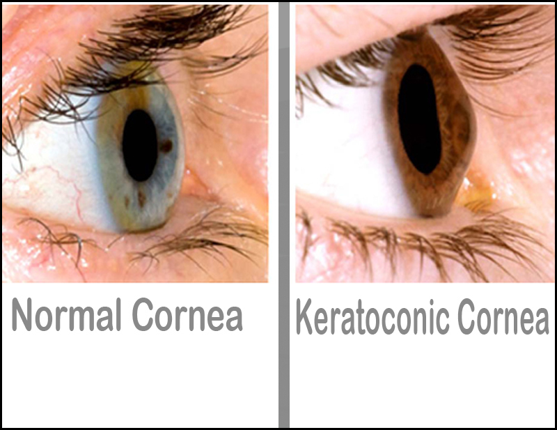 DD Eye Institute - C3R