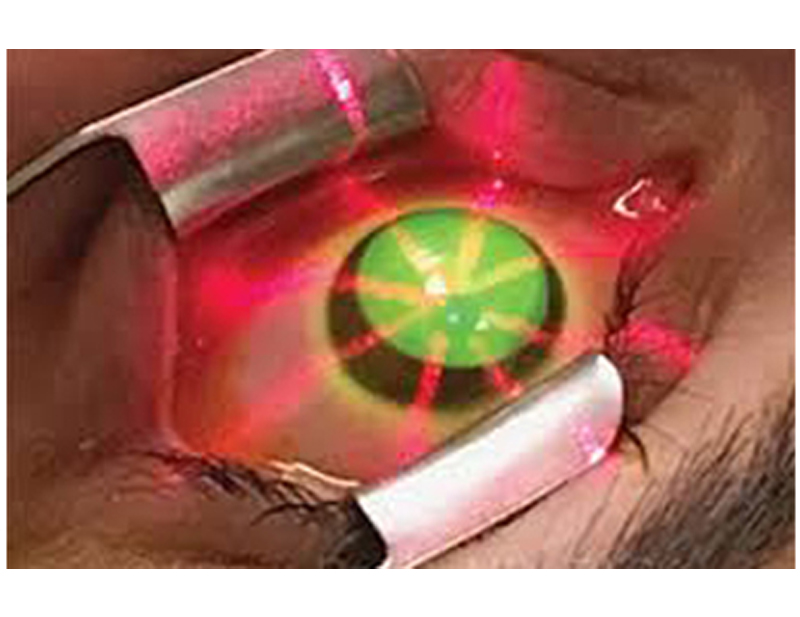 DD Eye Institute - C3R