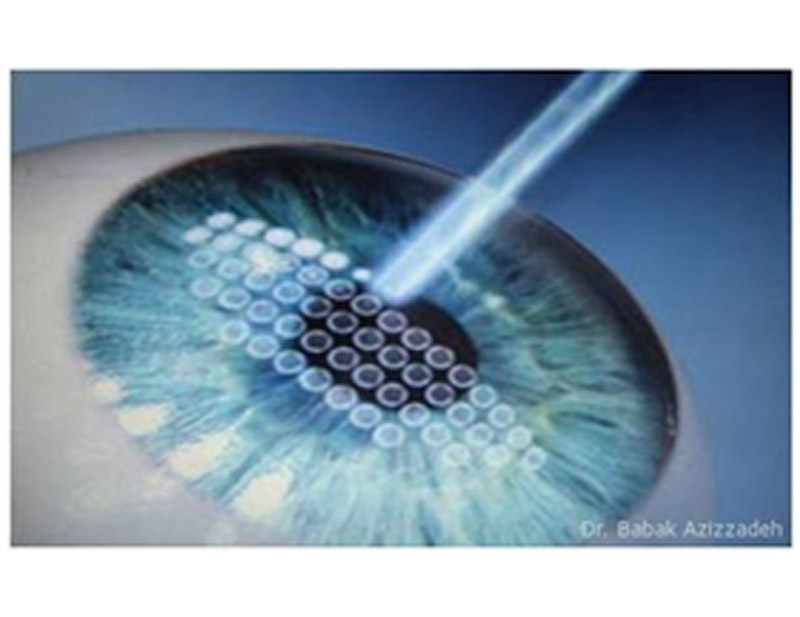 DD Eye