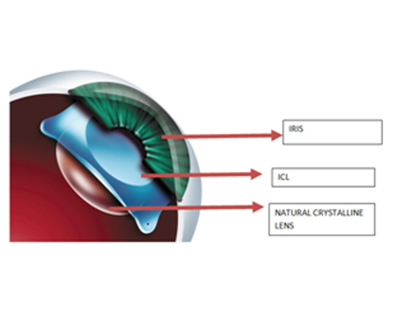 DD Eye