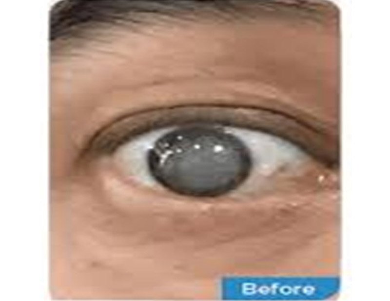 DD Eye