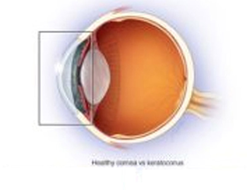 DD Eye