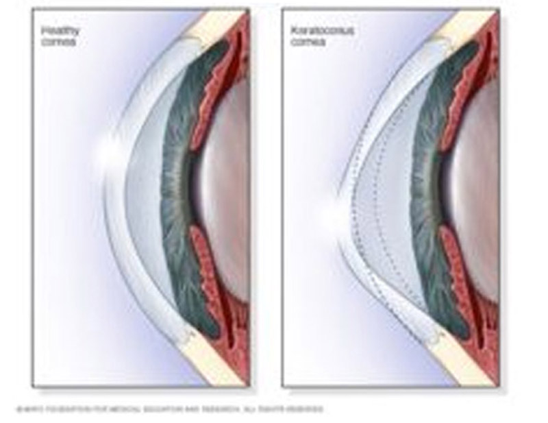 DD Eye
