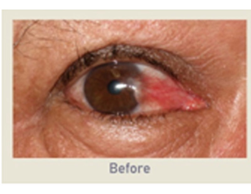 DD Eye