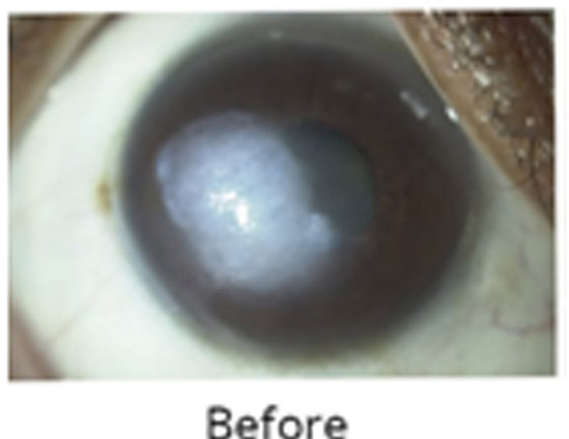 DD Eye