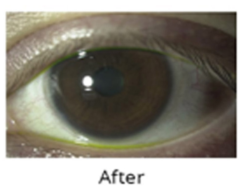 DD Eye