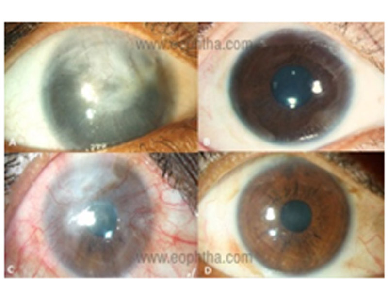 DD Eye