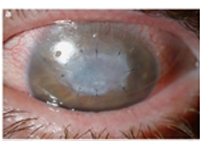 DD Eye