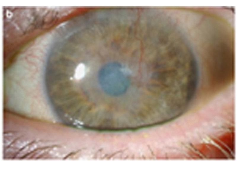 DD Eye