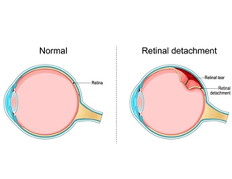 DD Eye