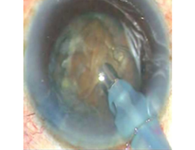DD Eye