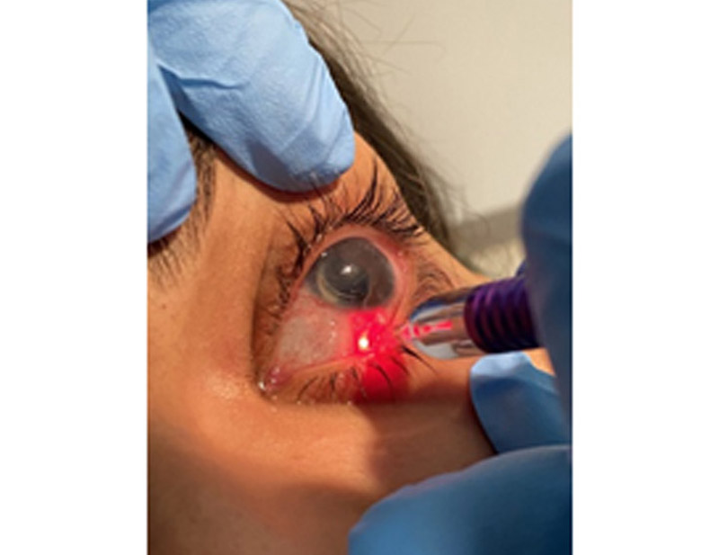 DD Eye