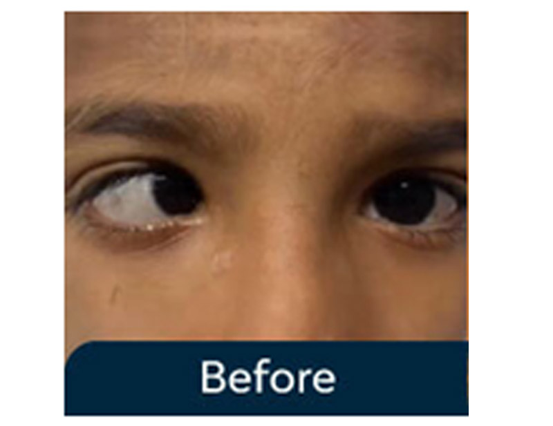 DD Eye