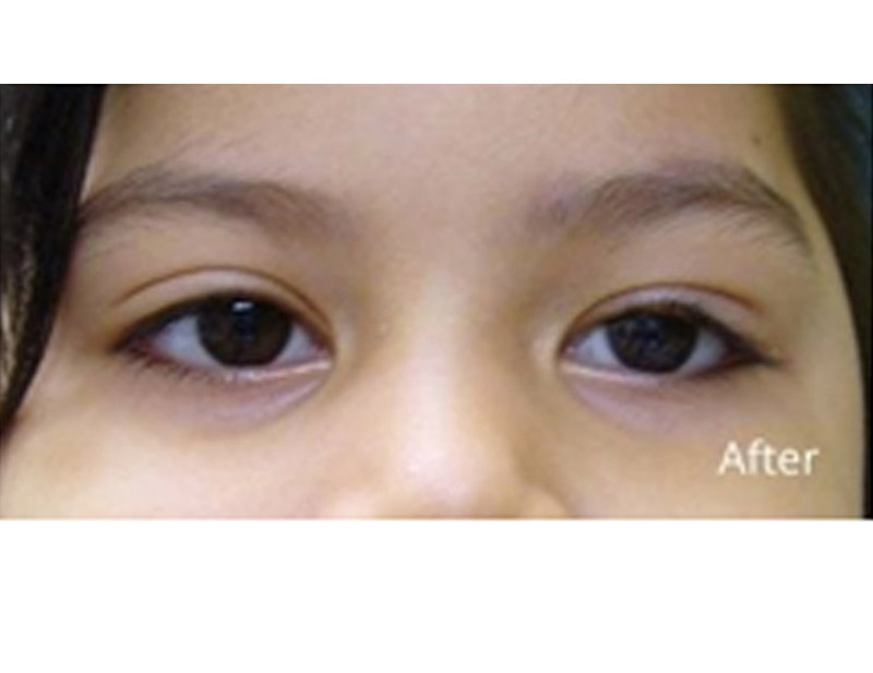 DD Eye