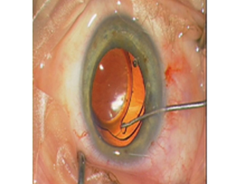 DD Eye