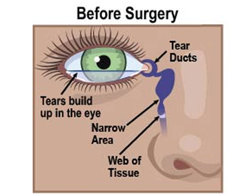 DD Eye