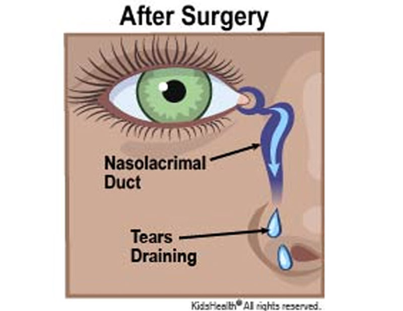 DD Eye