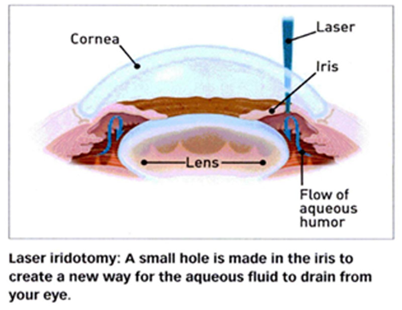 DD Eye
