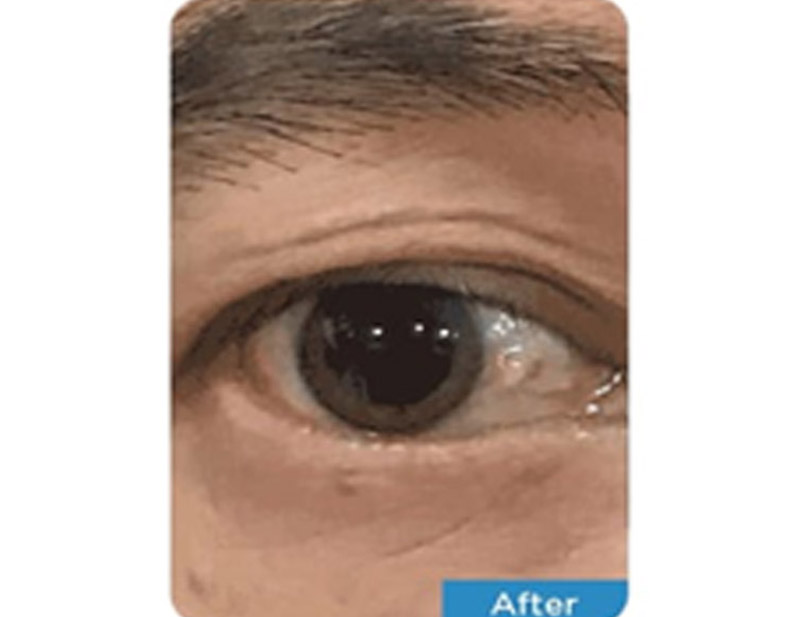 DD Eye